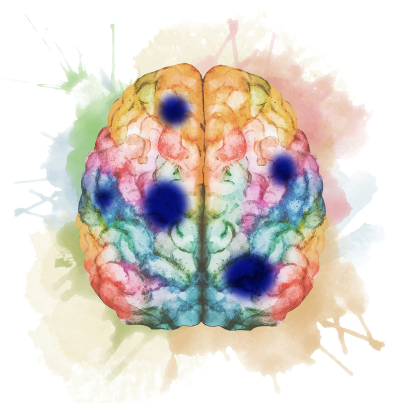 Artistic painterly rendition of a brain in colorful tones, with a few dark blue circles over different regions, representing 