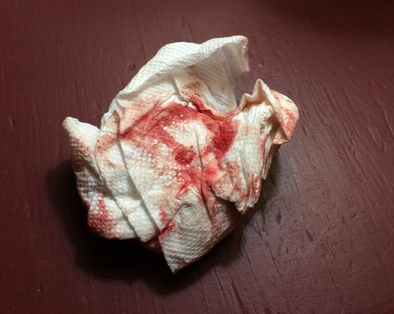 Image description: A crumpled paper towel full of red splotches.
